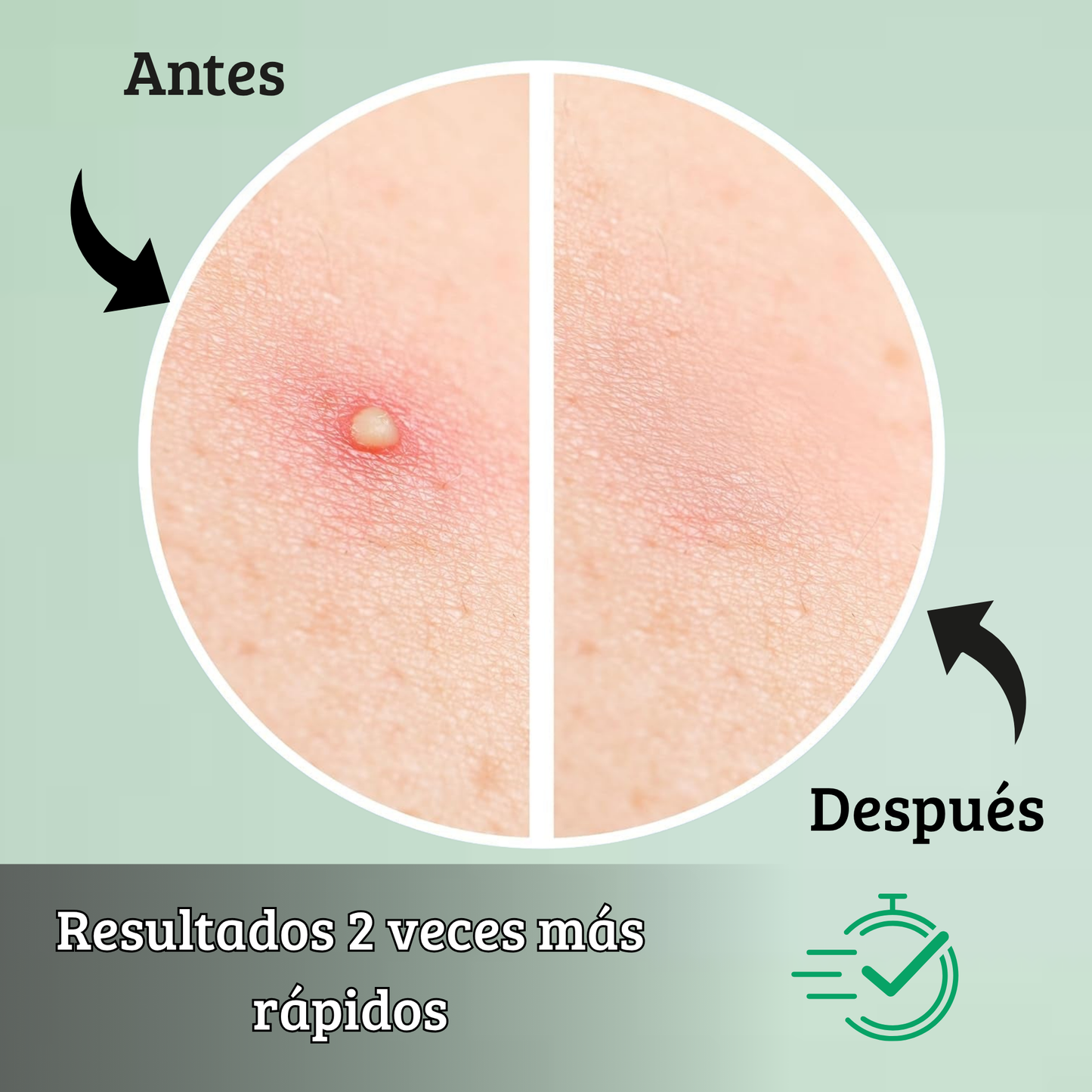ANTIGRAN (Patch RX)